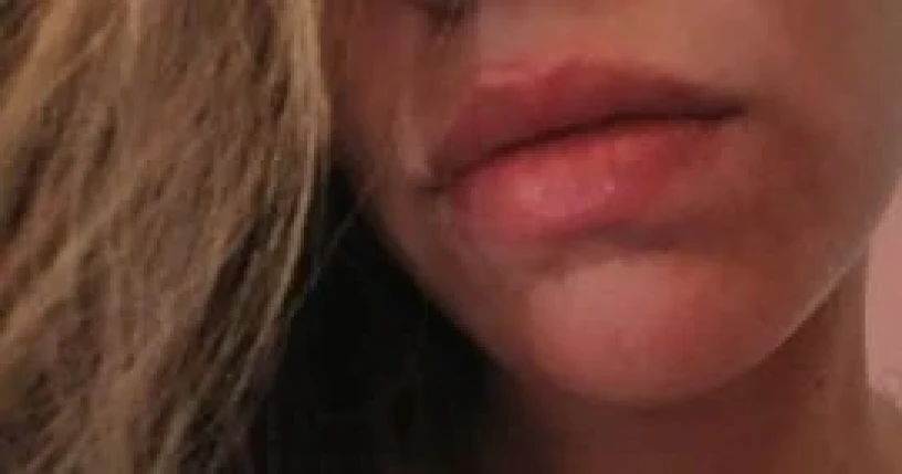 Miss Molly — 4 / 7