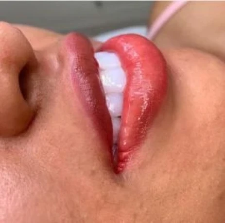 Suellen Gomes — 1 / 5