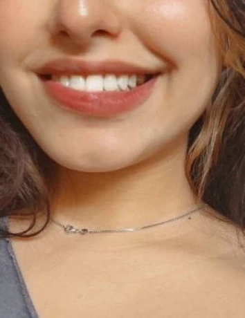 Iza Ferrraz — 1 / 5