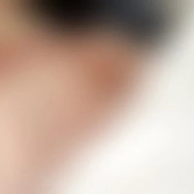 Lelu 20, Escort, Muhlhausen