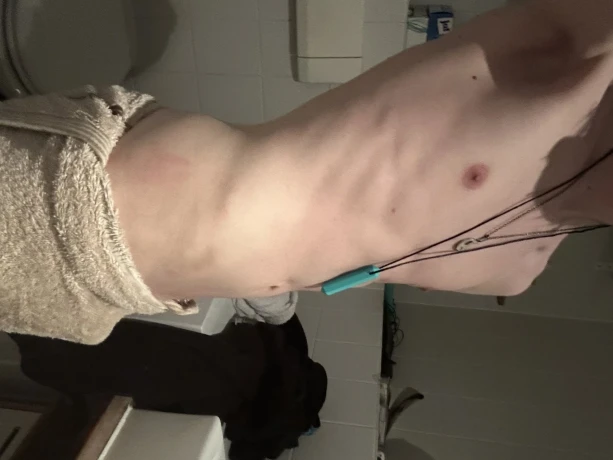 Incubusnex — 5 / 6