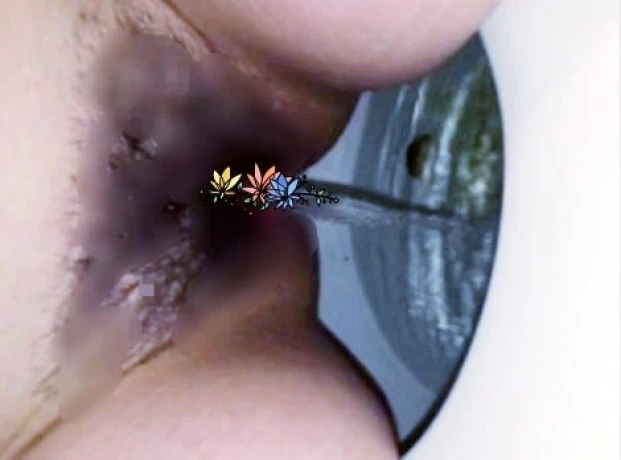 Beata 50 J Sehr Behaarte Milf — 1 / 5