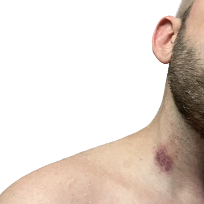 Extase, Escort, Biel/Bienne