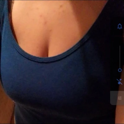 Anna593, Escort, Hannover