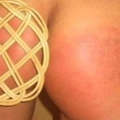 Du Boeser Junge Du Hast Du Wieder In Die Hose Gemacht, Escort, Sursee