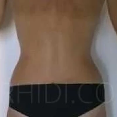 Nikol, Escort, Prague